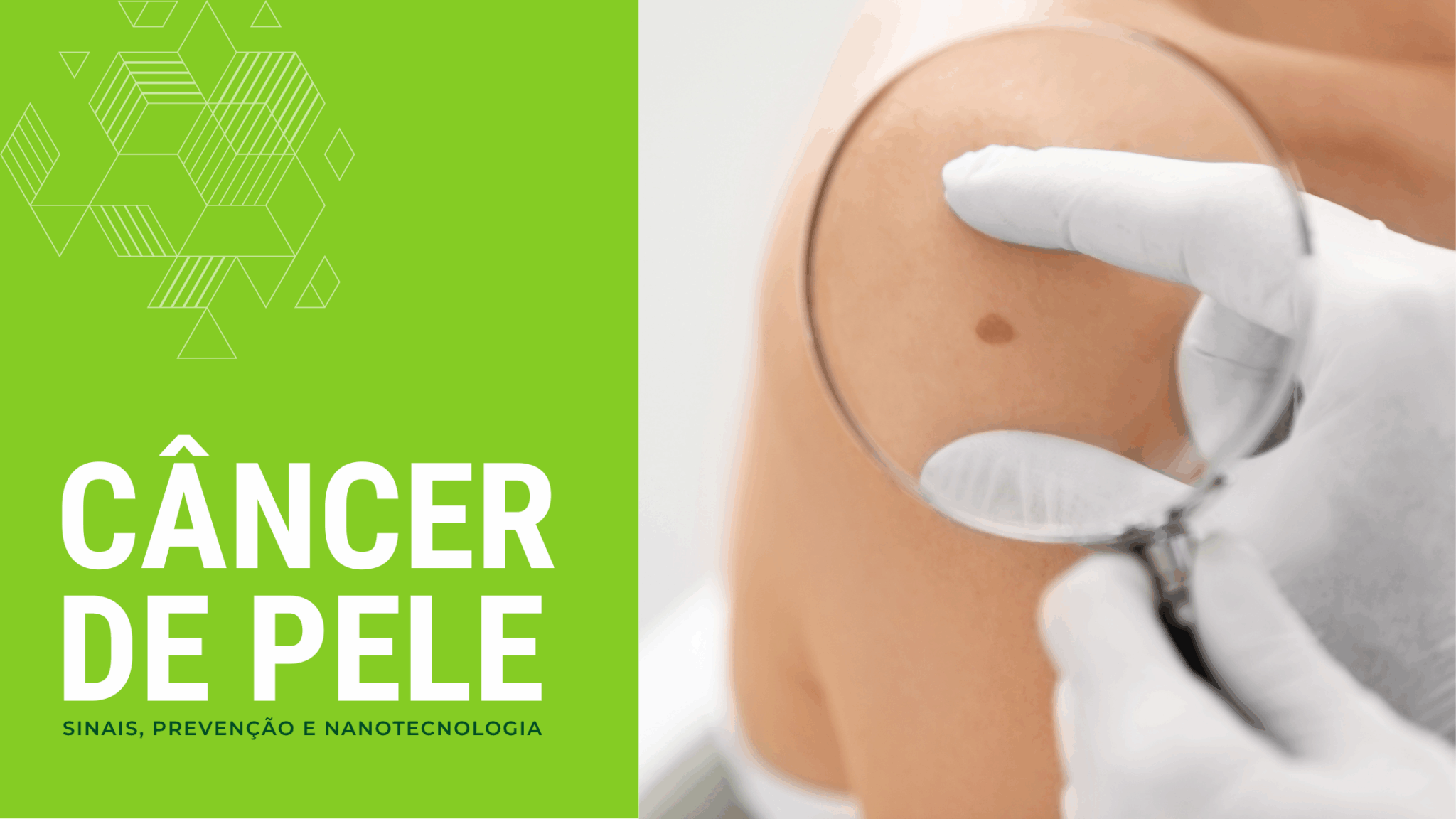 Câncer de pele: sinais, prevenção e nanotecnologia