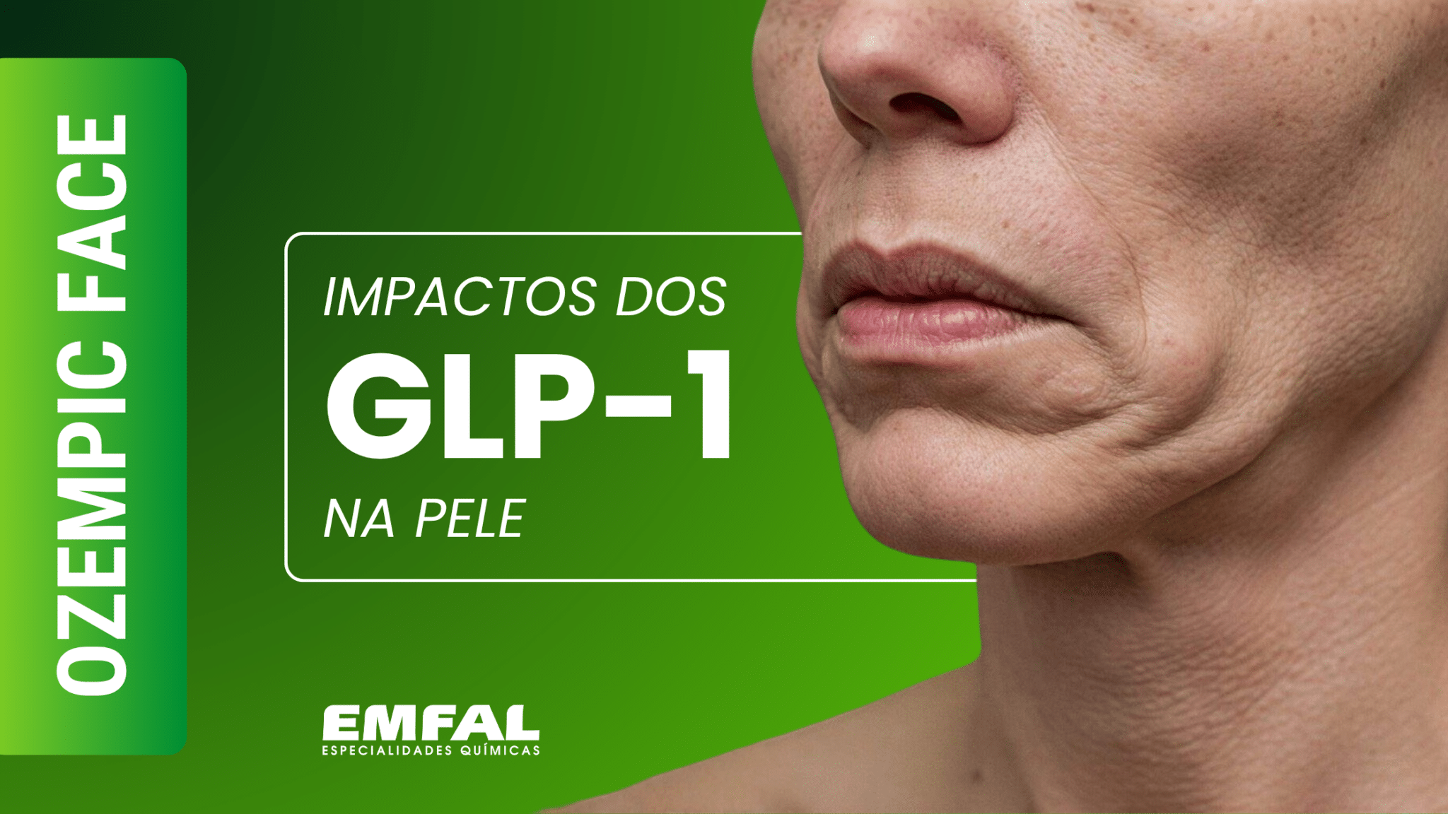 Ozempic Face impactos dos GLP-1 na pele